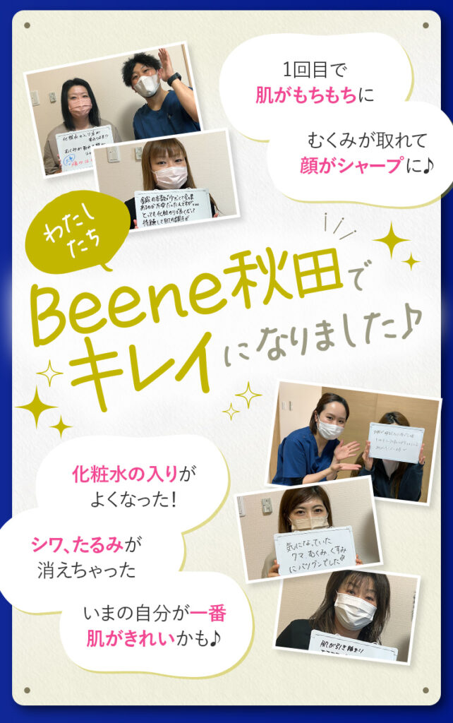 秋田市周辺のたくさんの女性がBeene秋田の肌育できる美容鍼でキレイになっています